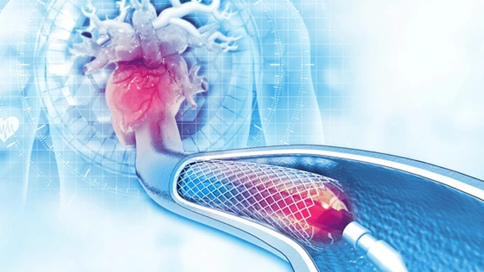 ACC 2026 | Estudio IVUS-CHIP: Una mirada al interior del corazón para mejorar las angioplastias complejas | Grupo i2
